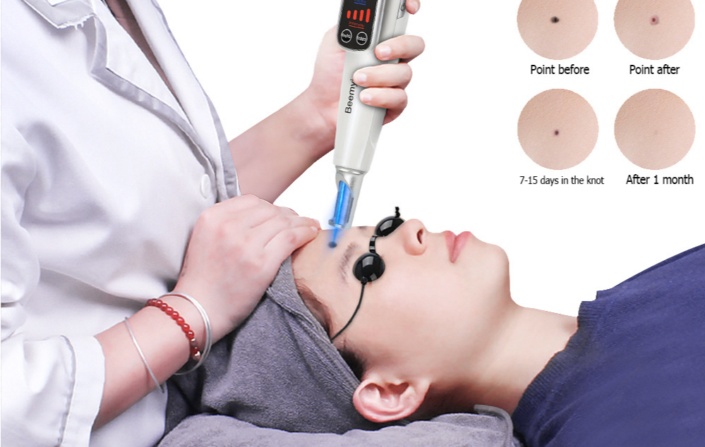 激光祛斑美容儀安全認證(圖1)